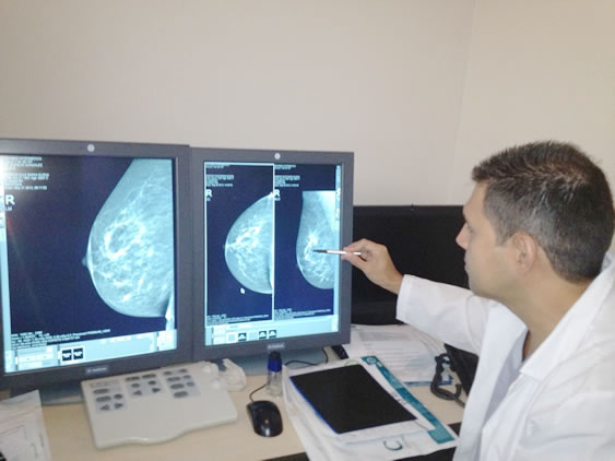 Cancer de seno tratamiento Medellin Alexander Rodriguez